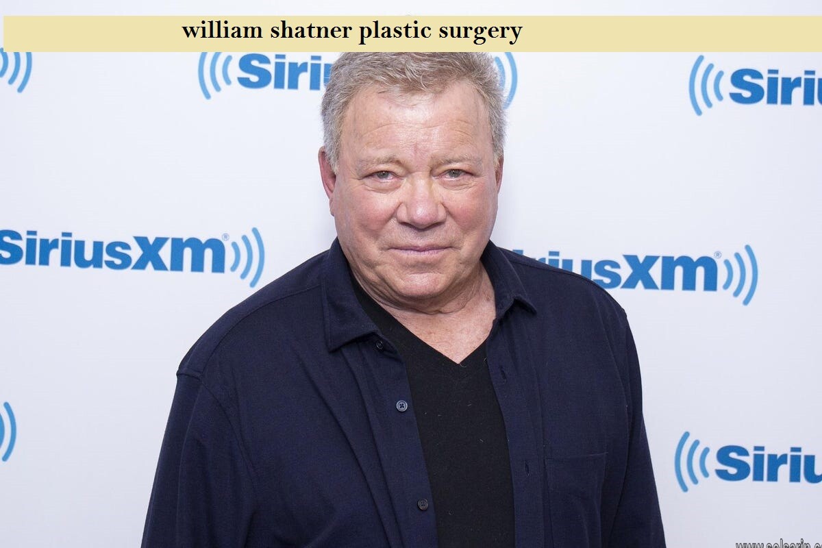 william shatner plastic surgery