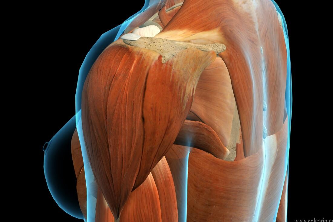 deltoid muscle pain tendonitis