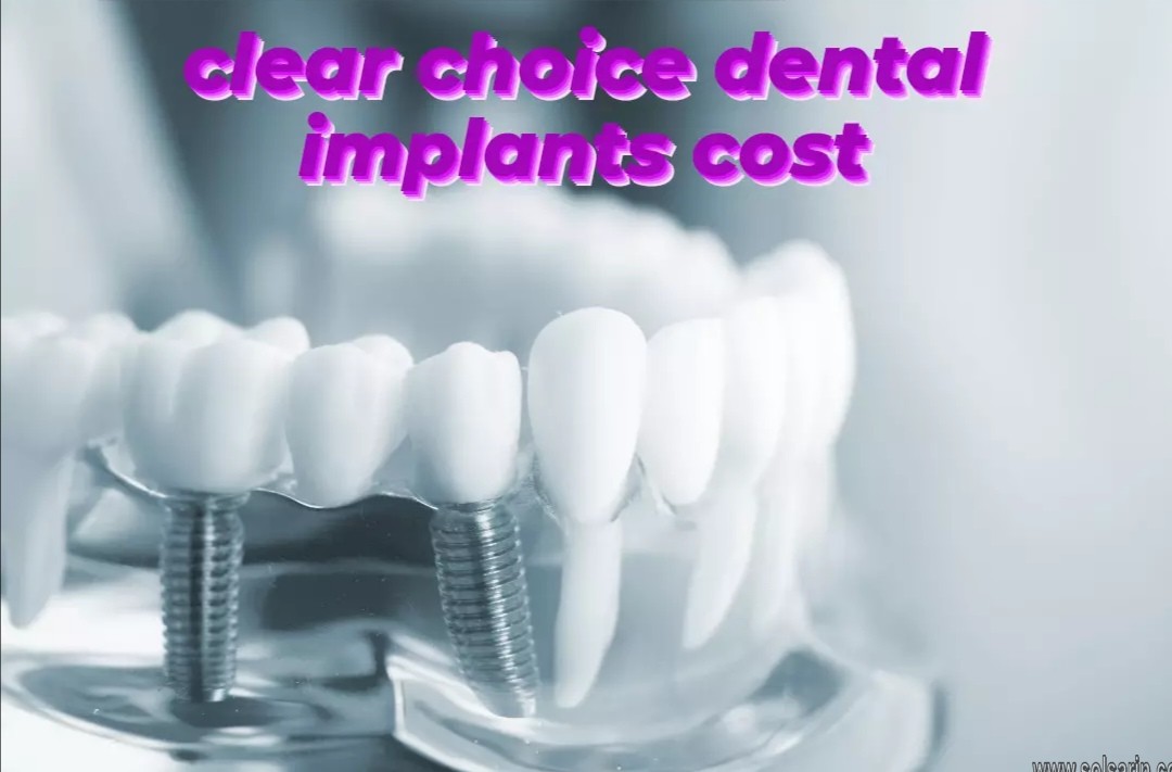 clear choice dental implants cost