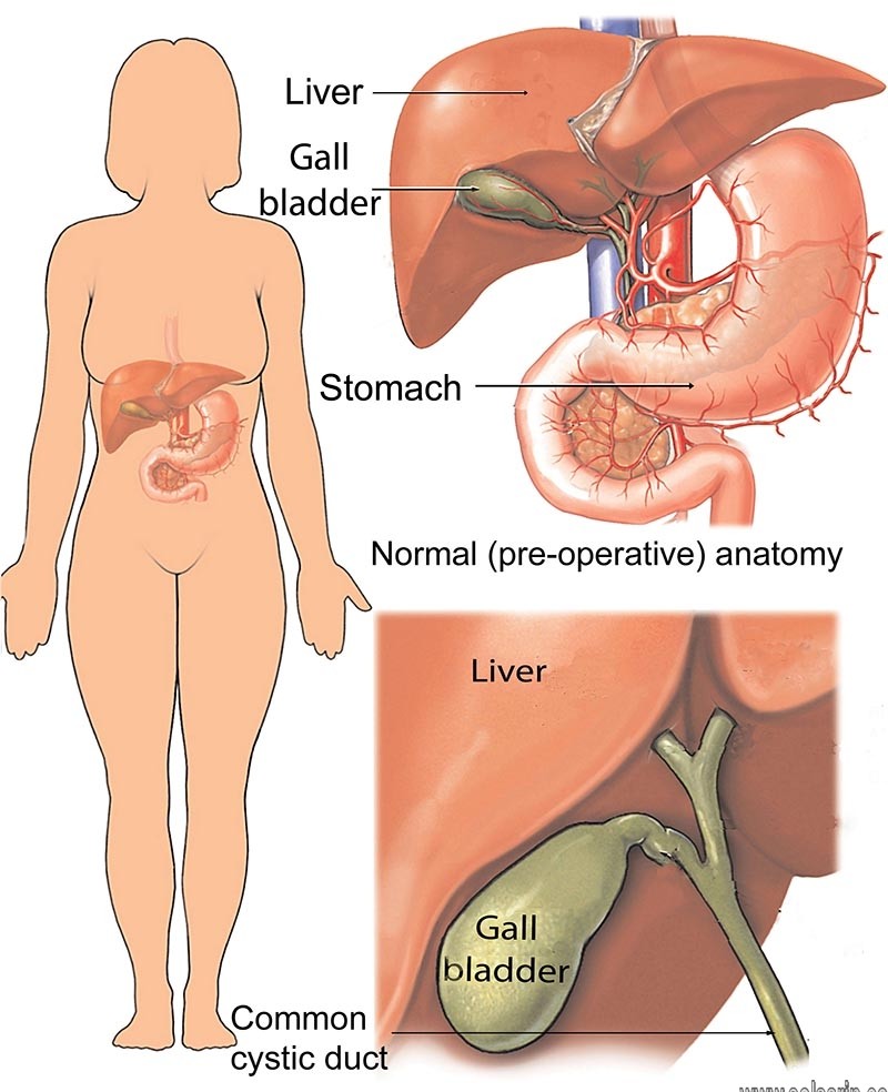 gallbladder removal medical term