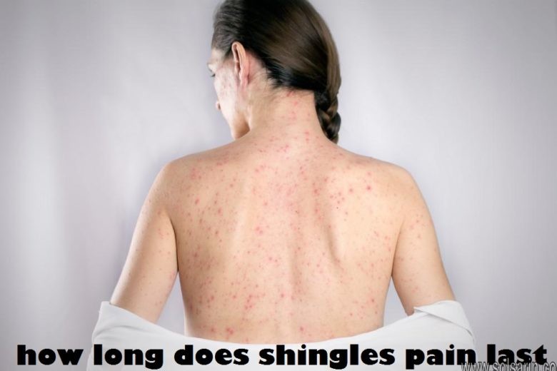 how long does shingles pain last