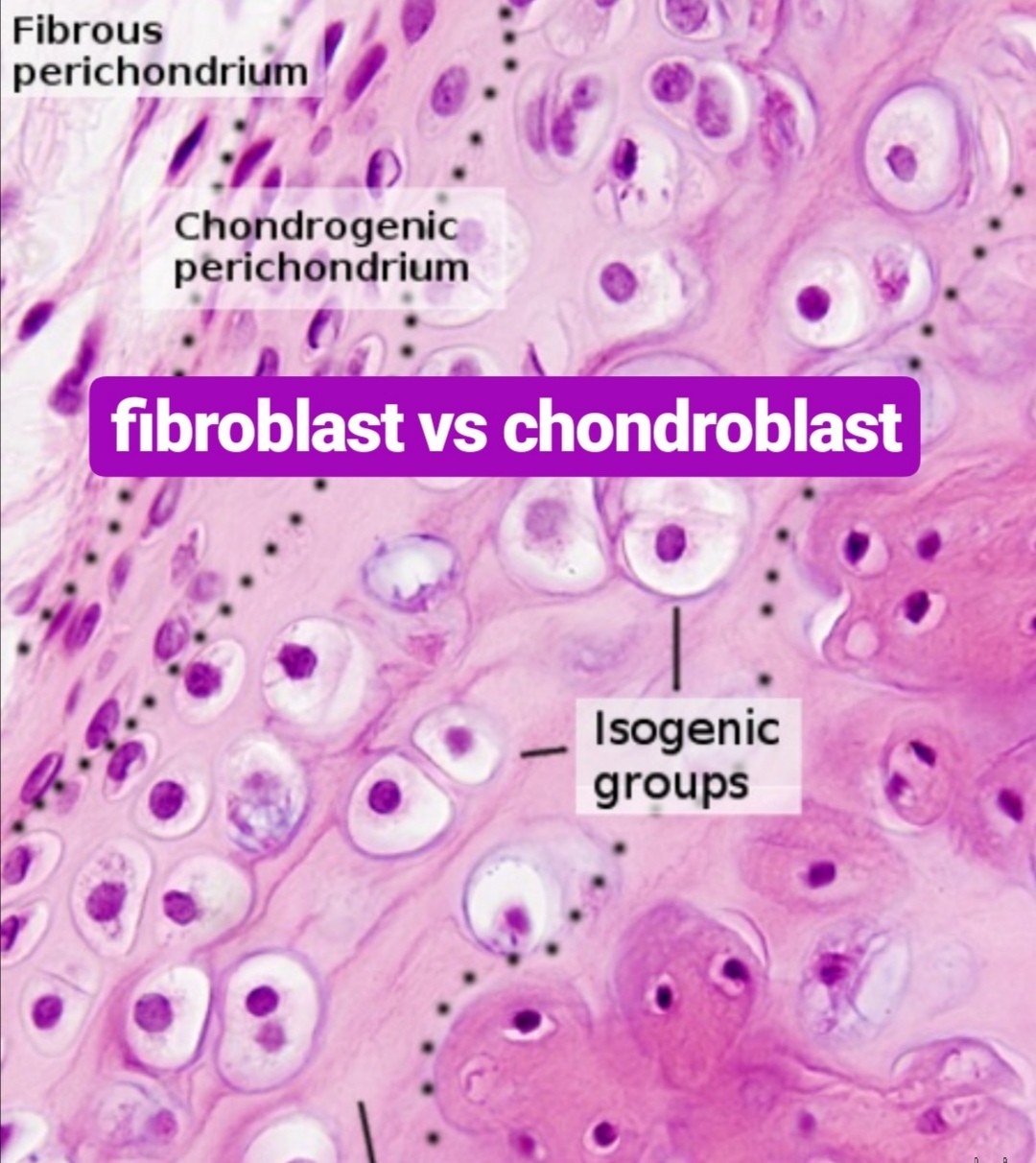 fibroblast vs chondroblast