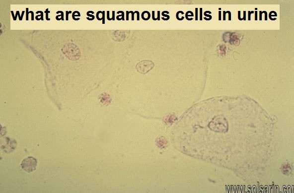 what are squamous cells in urine