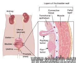 what are squamous cells in urine