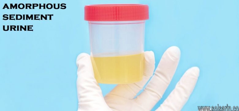 amorphous sediment urine