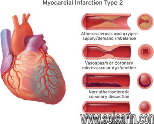 Pathophysiology of myocardial infarction