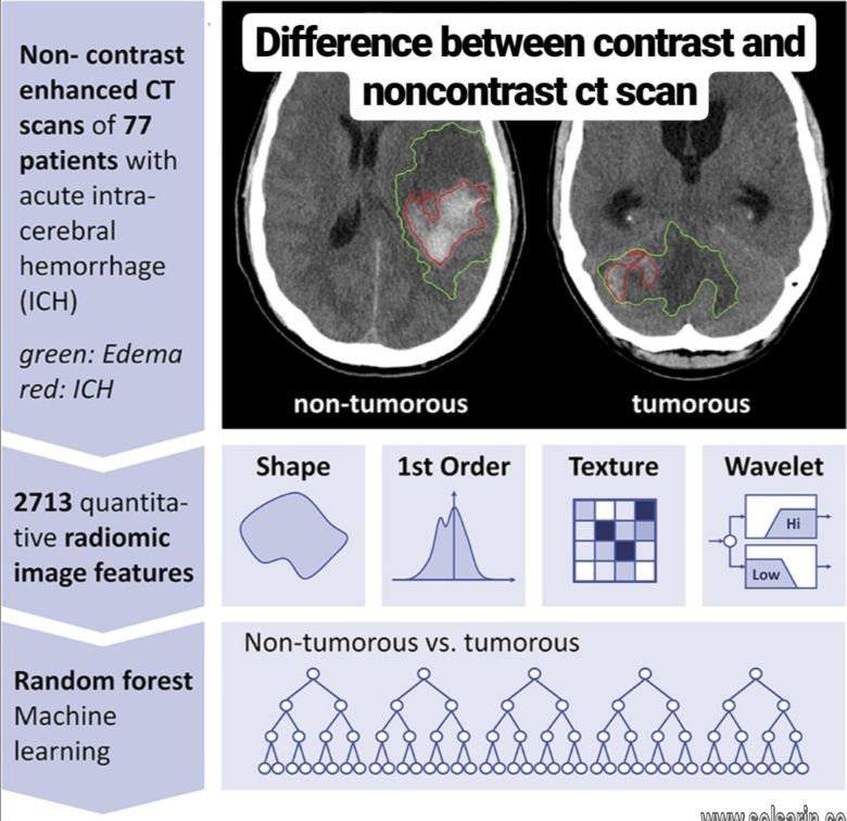 difference between contrast and noncontrast ct scan