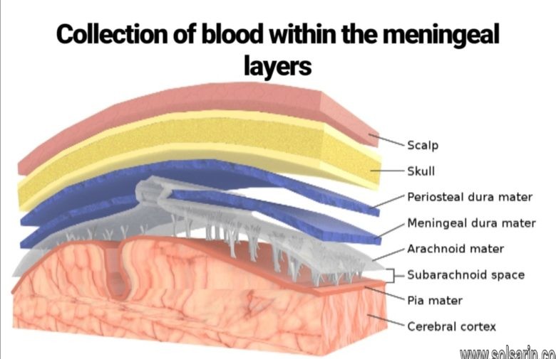 collection of blood within the meningeal layers