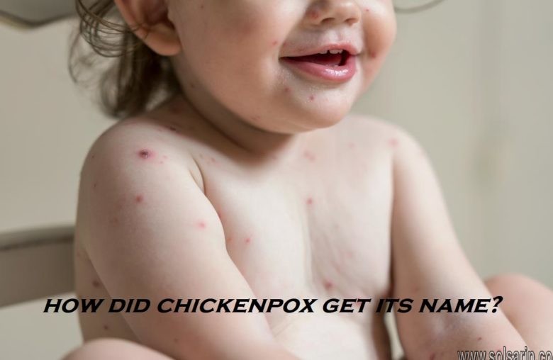 how did chickenpox get its name?