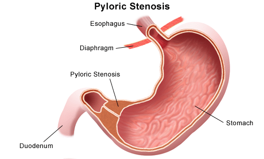 what is one function of the pyloric sphincter?