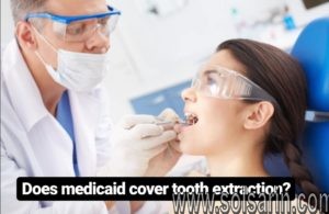 does medicaid cover tooth extraction